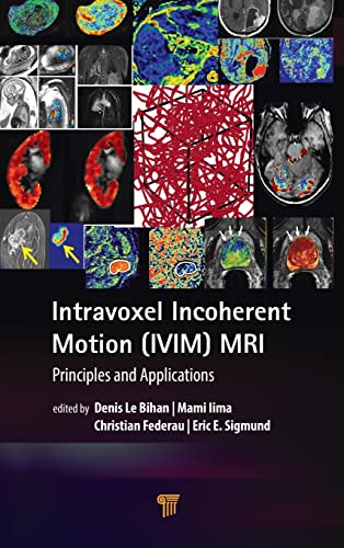 Intravoxel Incoherent MotionMRI