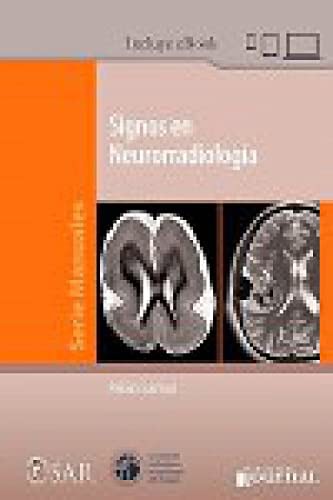 Signos en Neurorradiología