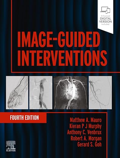 Image-Guided Interventions - E-BOOK: Expert Radiology Series