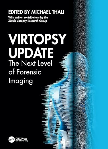 Virtopsy Update: The Next Level of Forensic Imaging